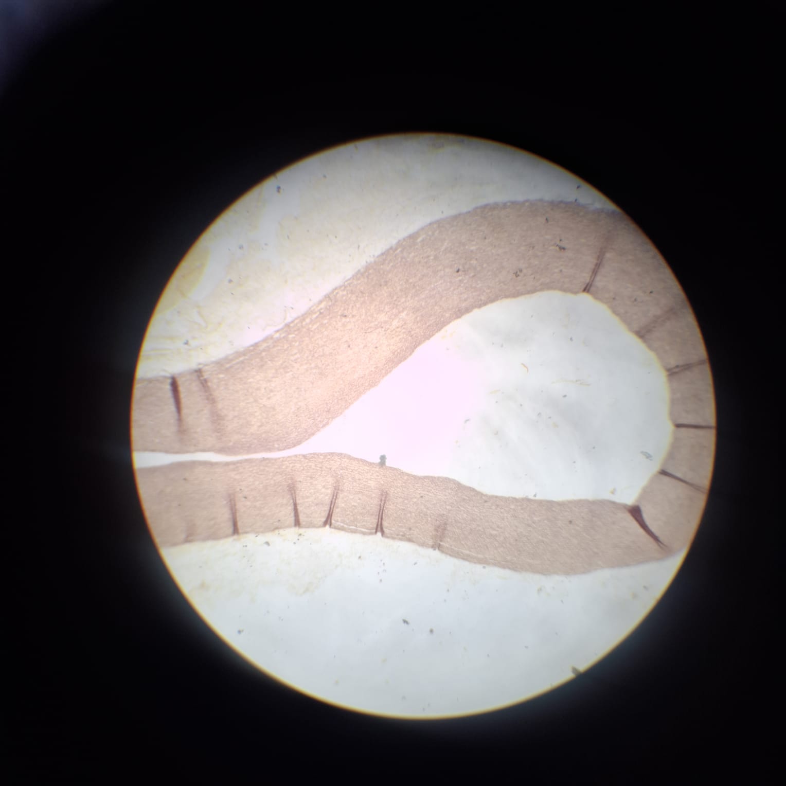 Elastic Artery