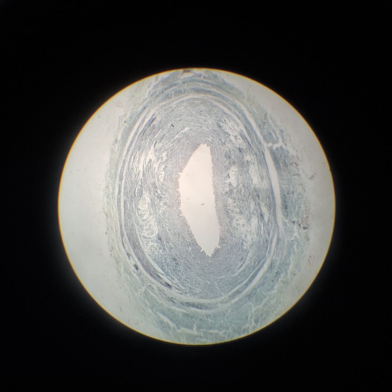 Muscular Artery