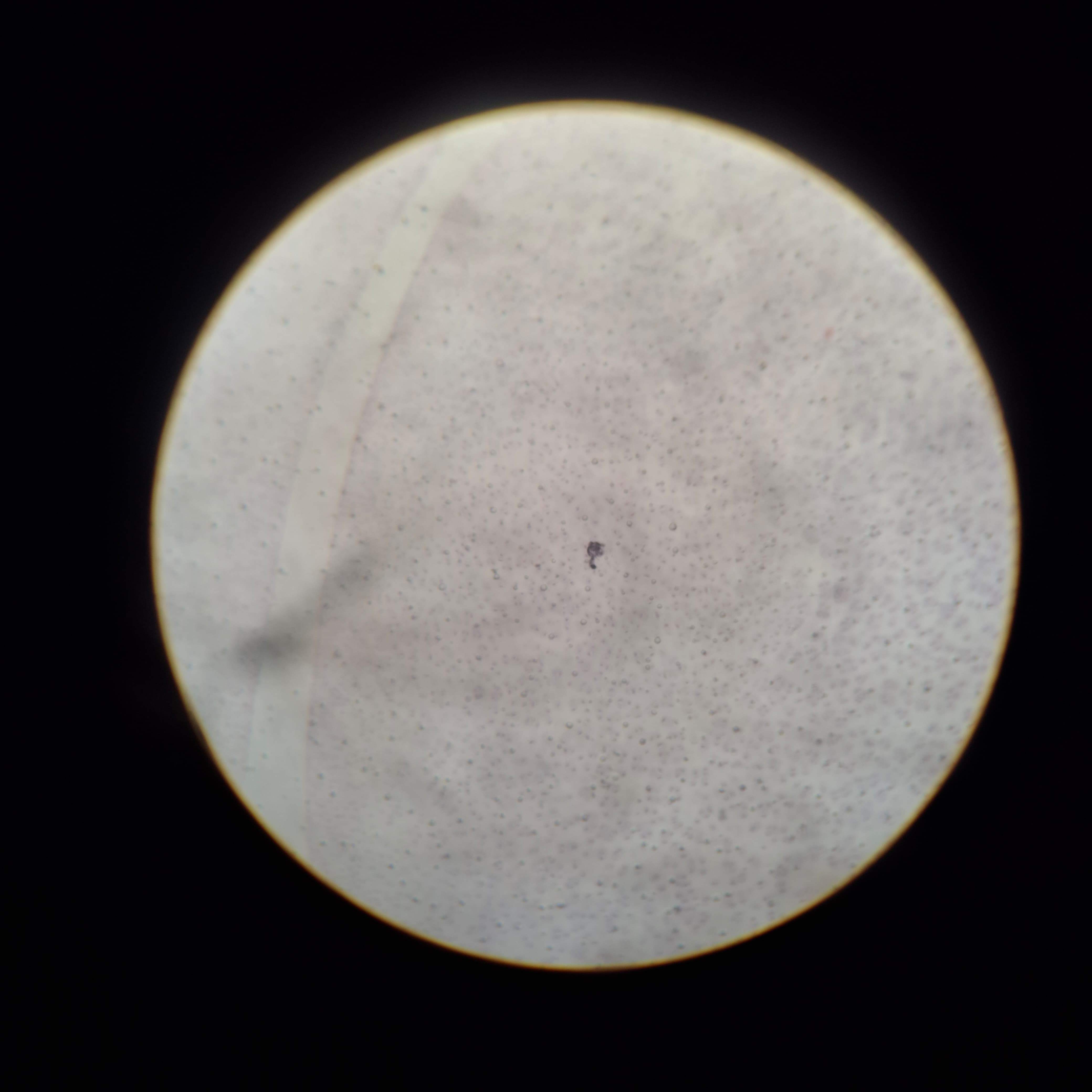 Articular Cartilage