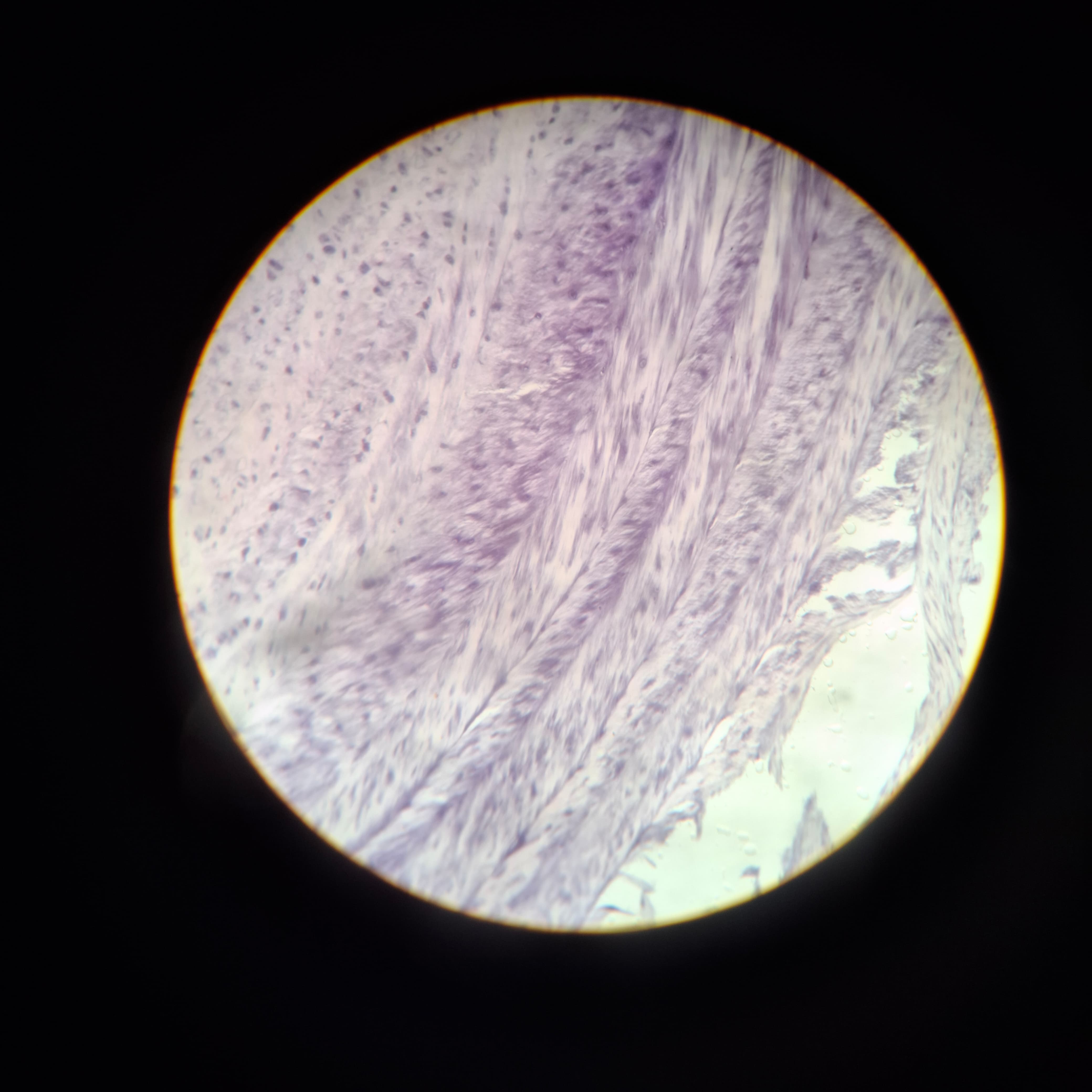 Fibrocartilage
