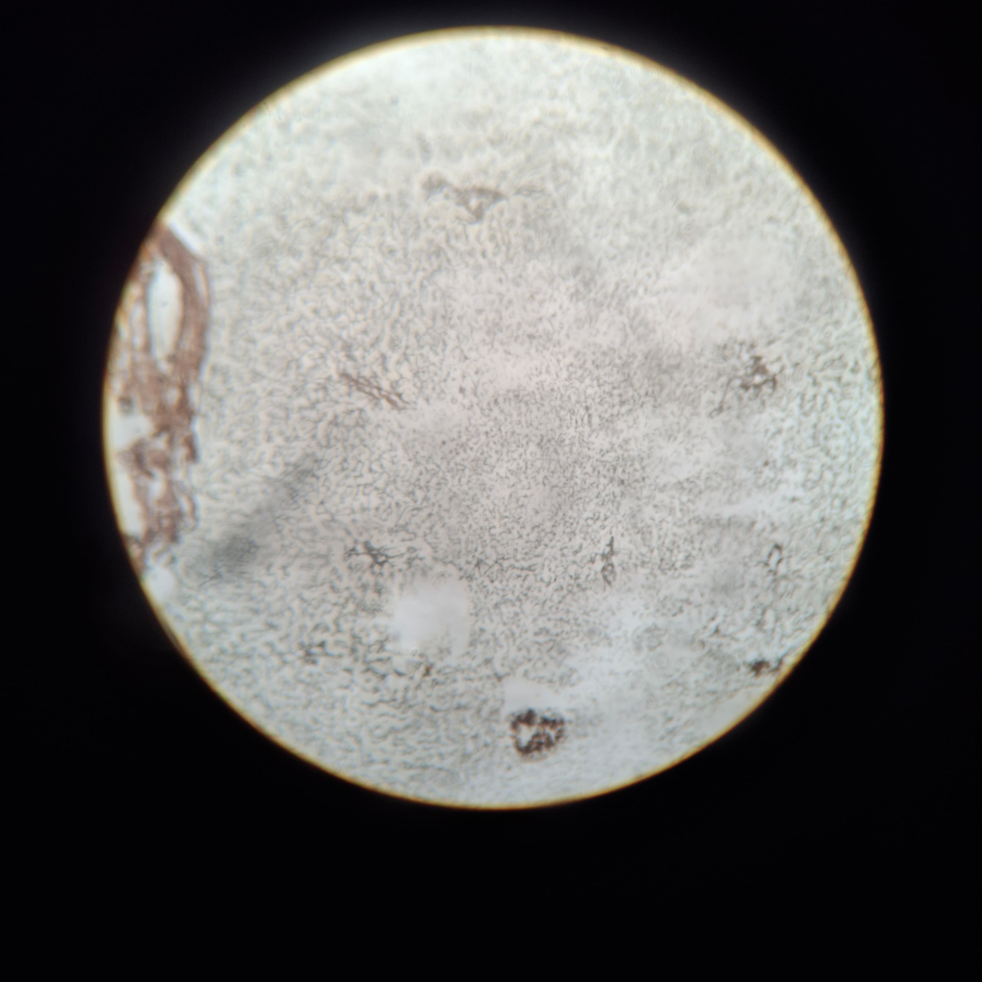 Reticular Tissue