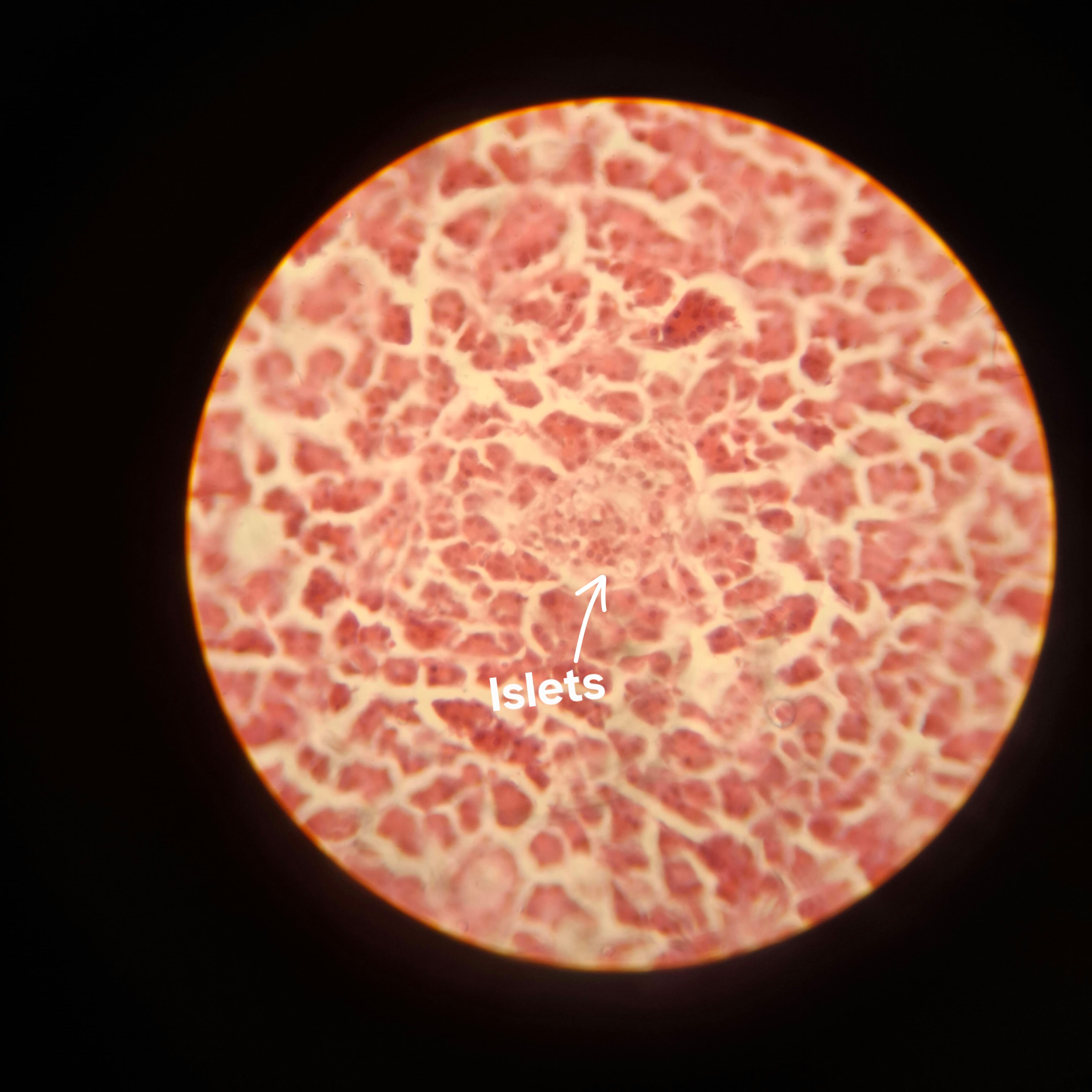 Islets of Langerhans