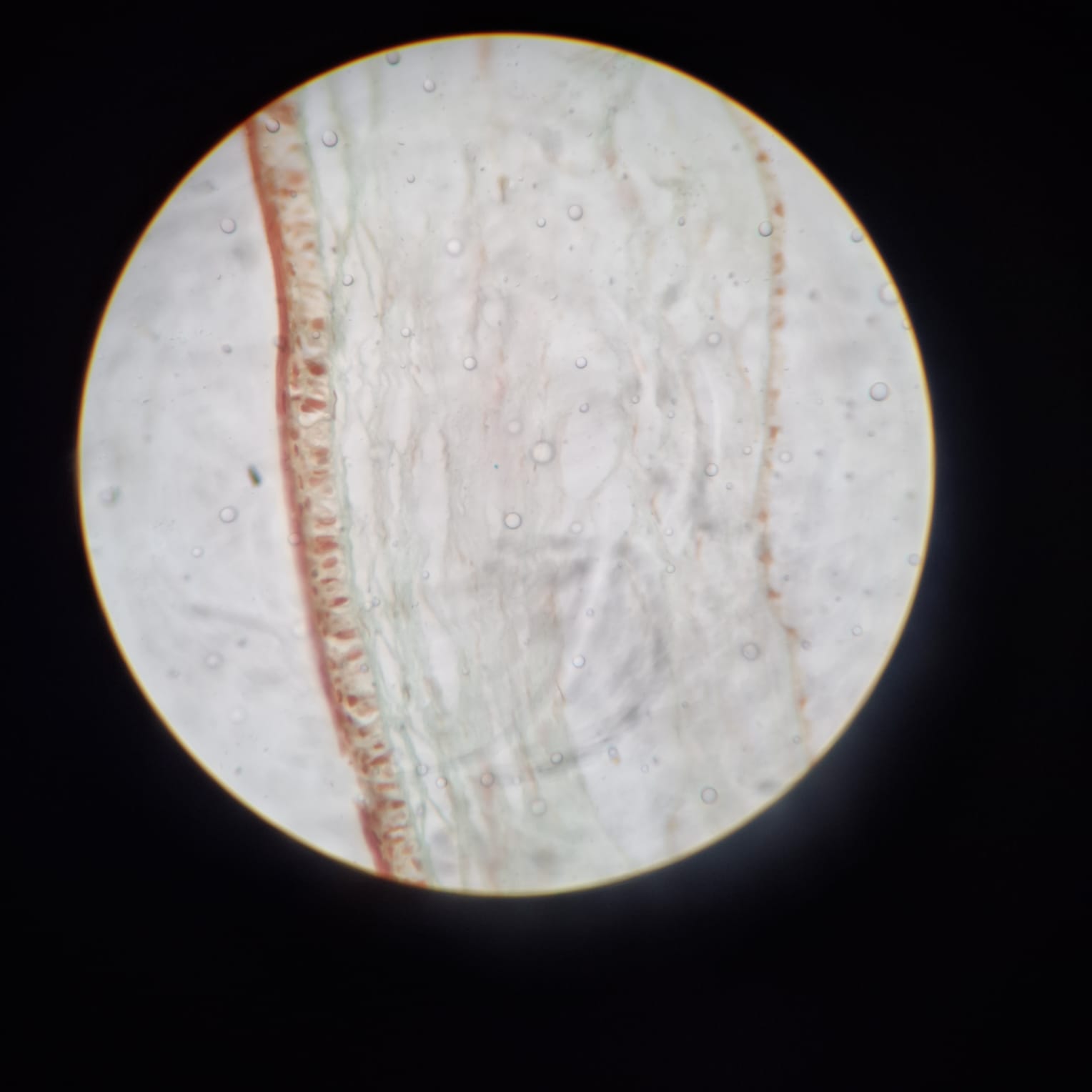 Cornea