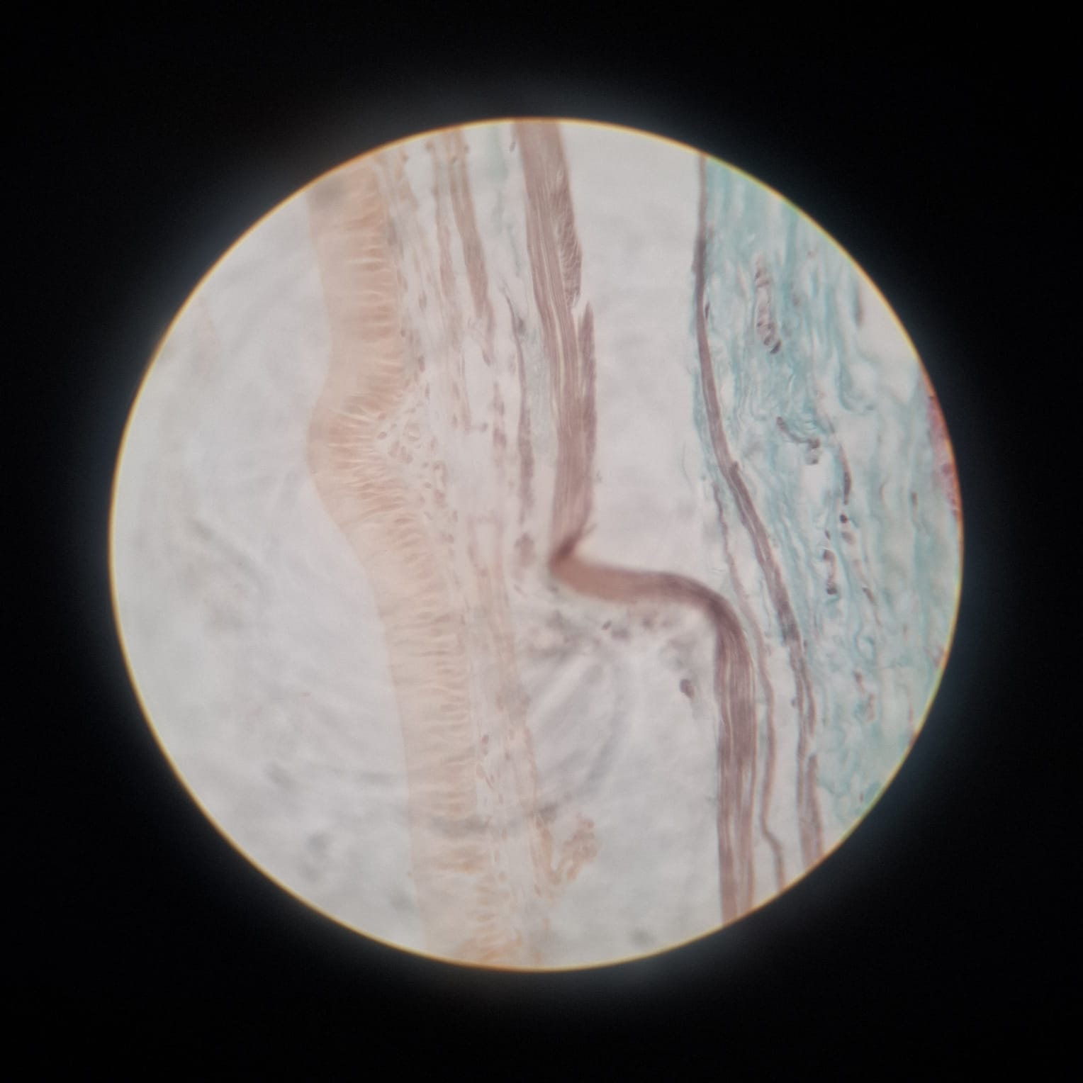 Gall Bladder