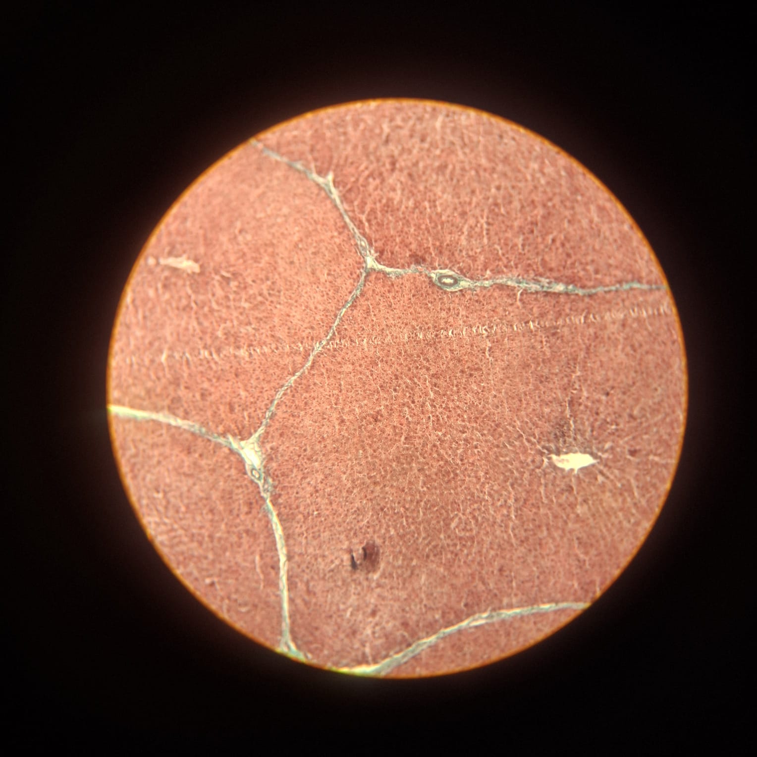 Liver
