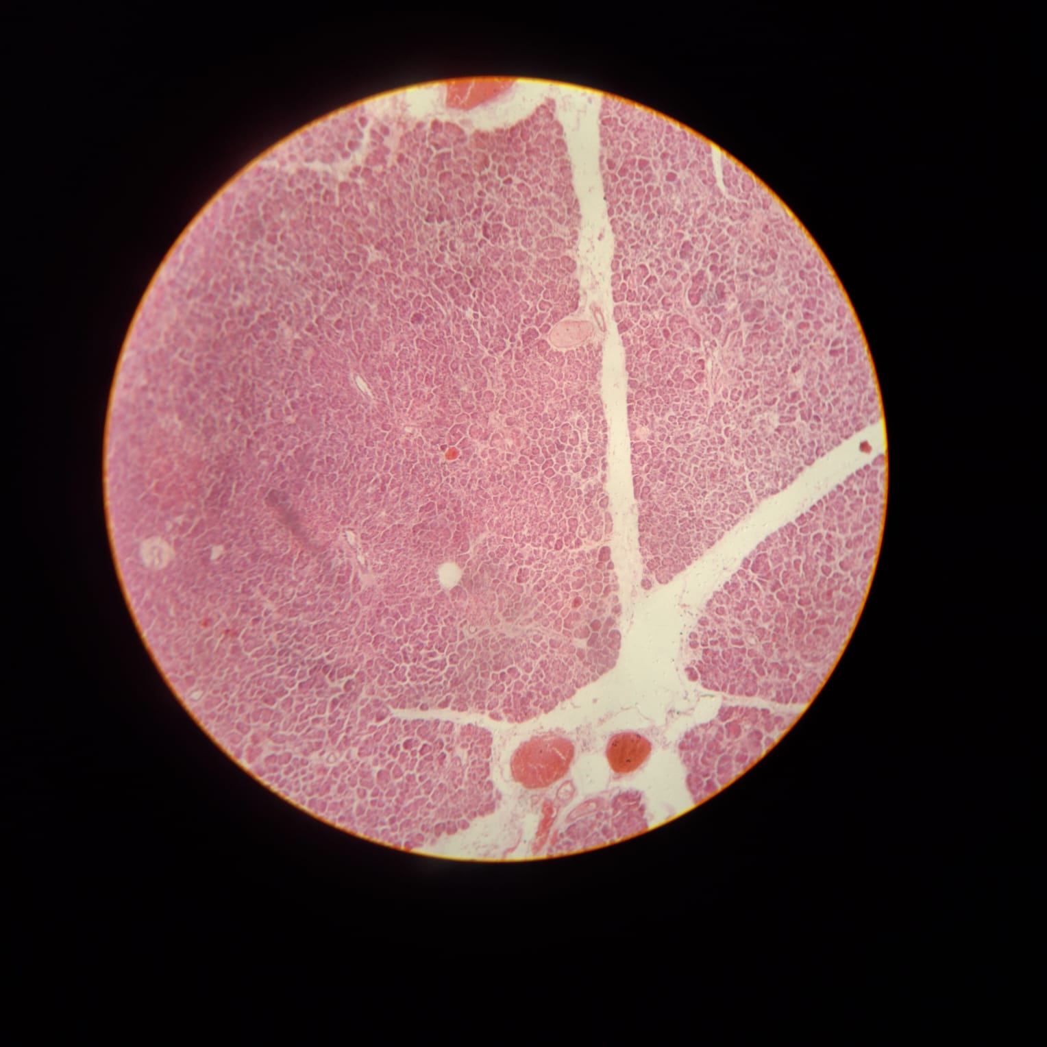 Pancreas