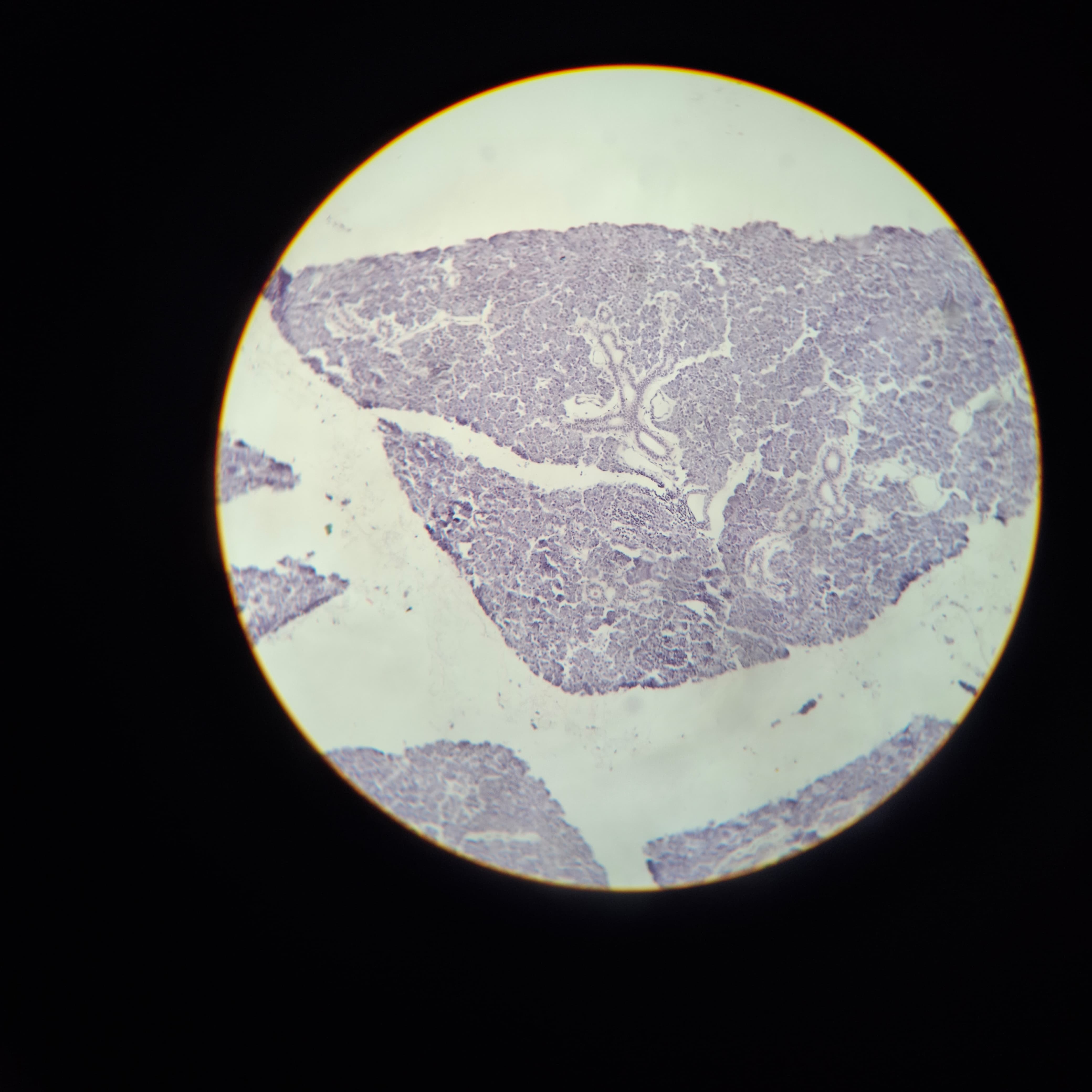 Parotid Gland