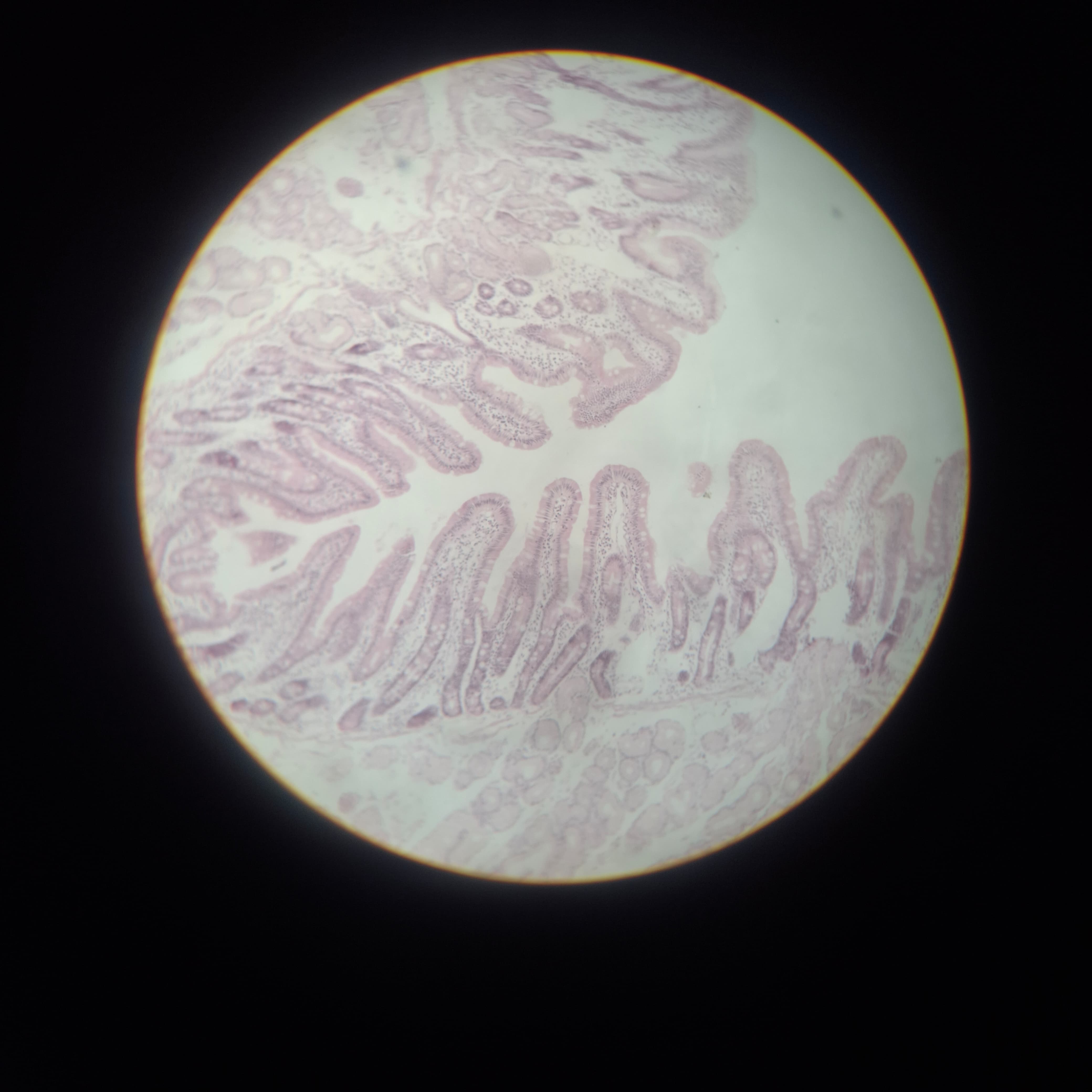Duodenum with Brunner's glands