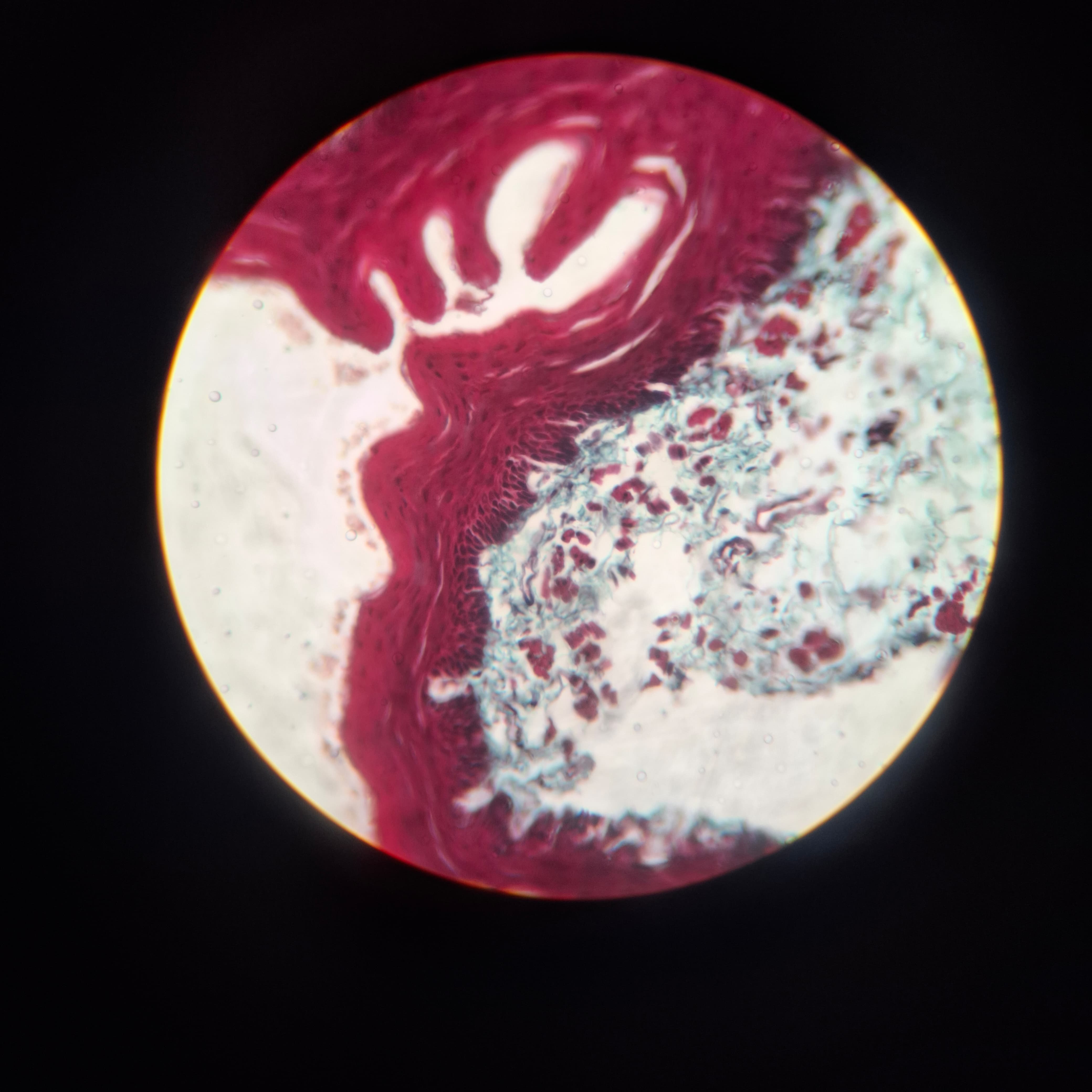 Esophagus