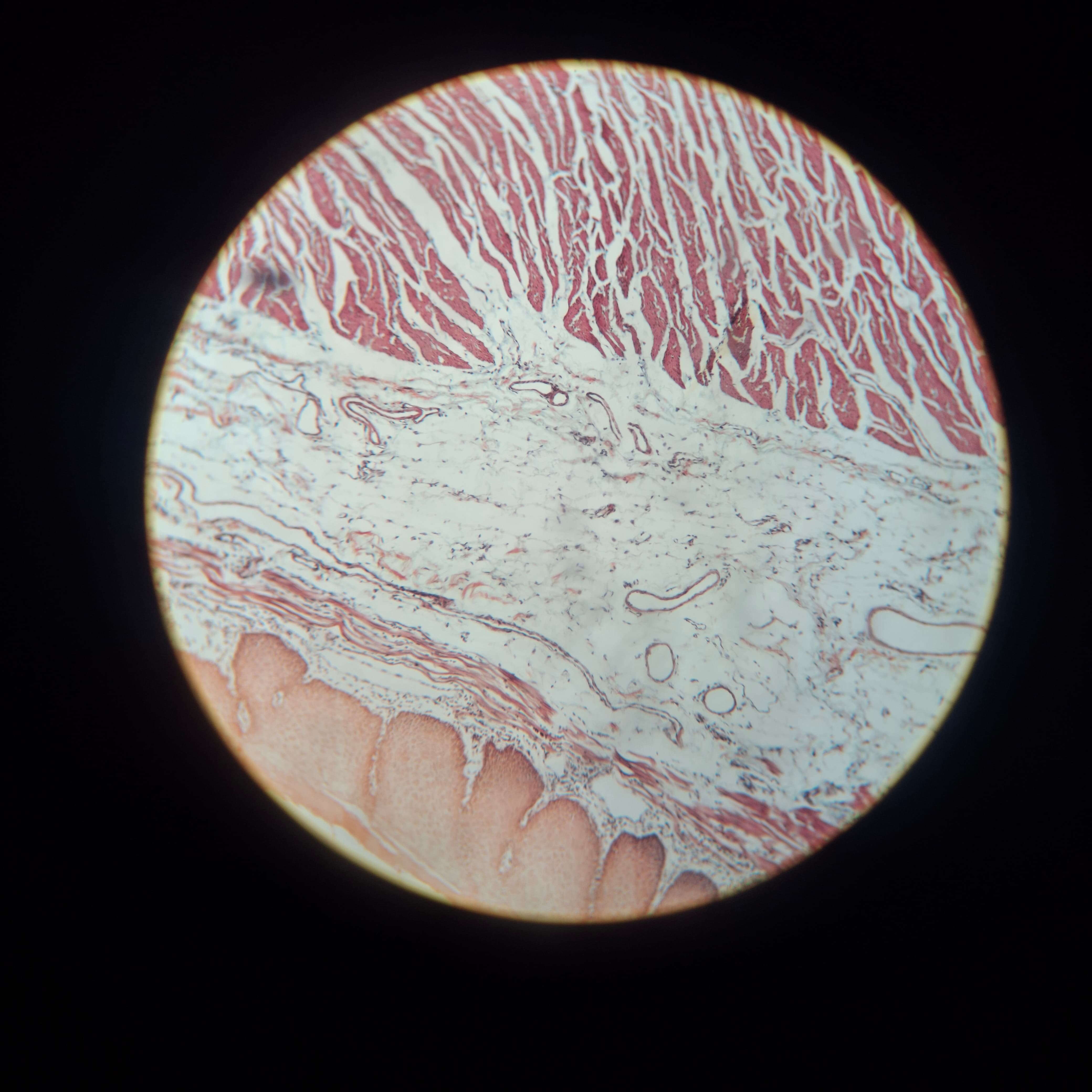 Jejunum
