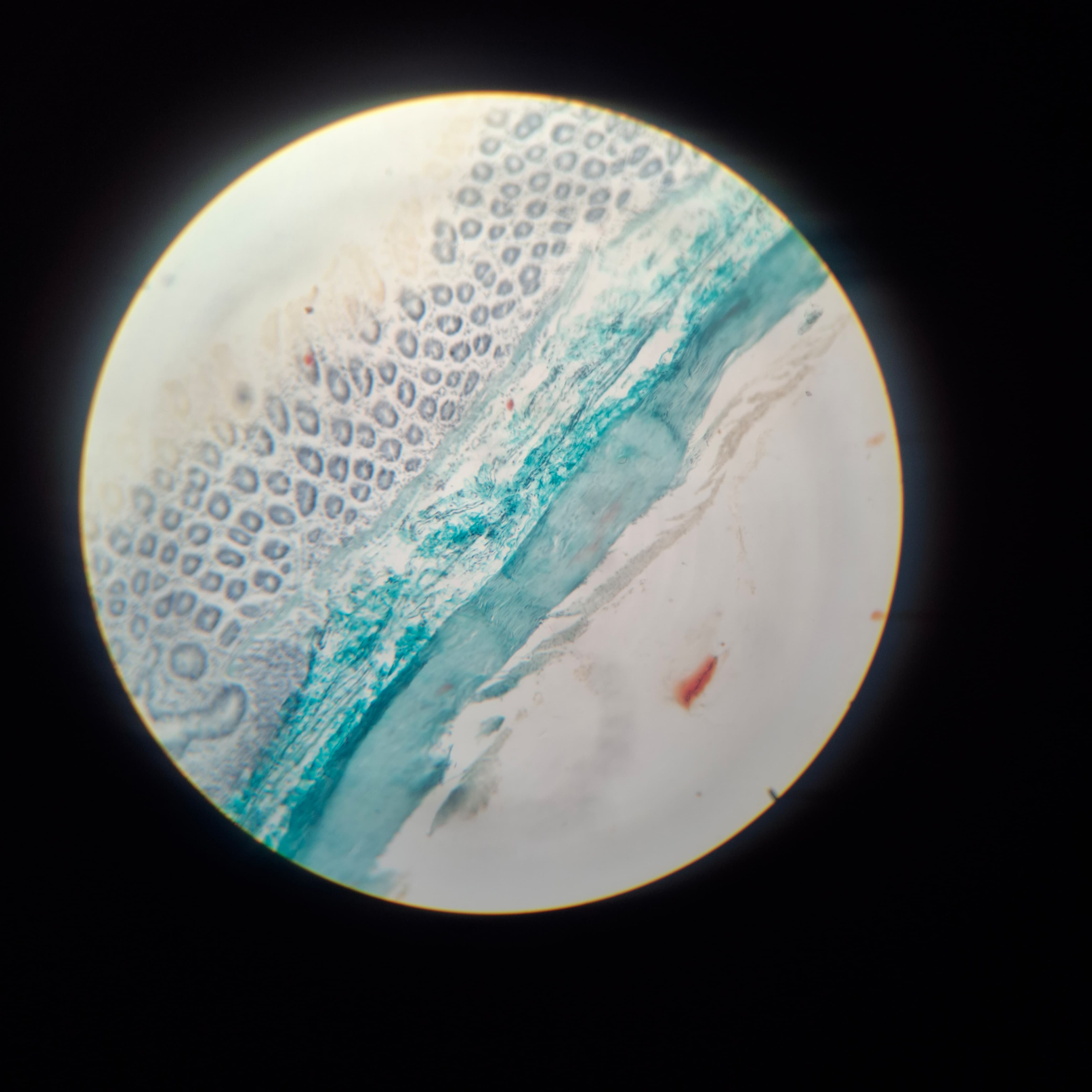 Large Intestine
