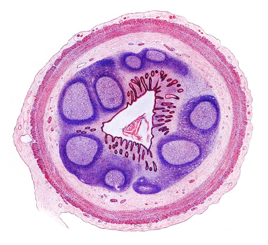 Appendix