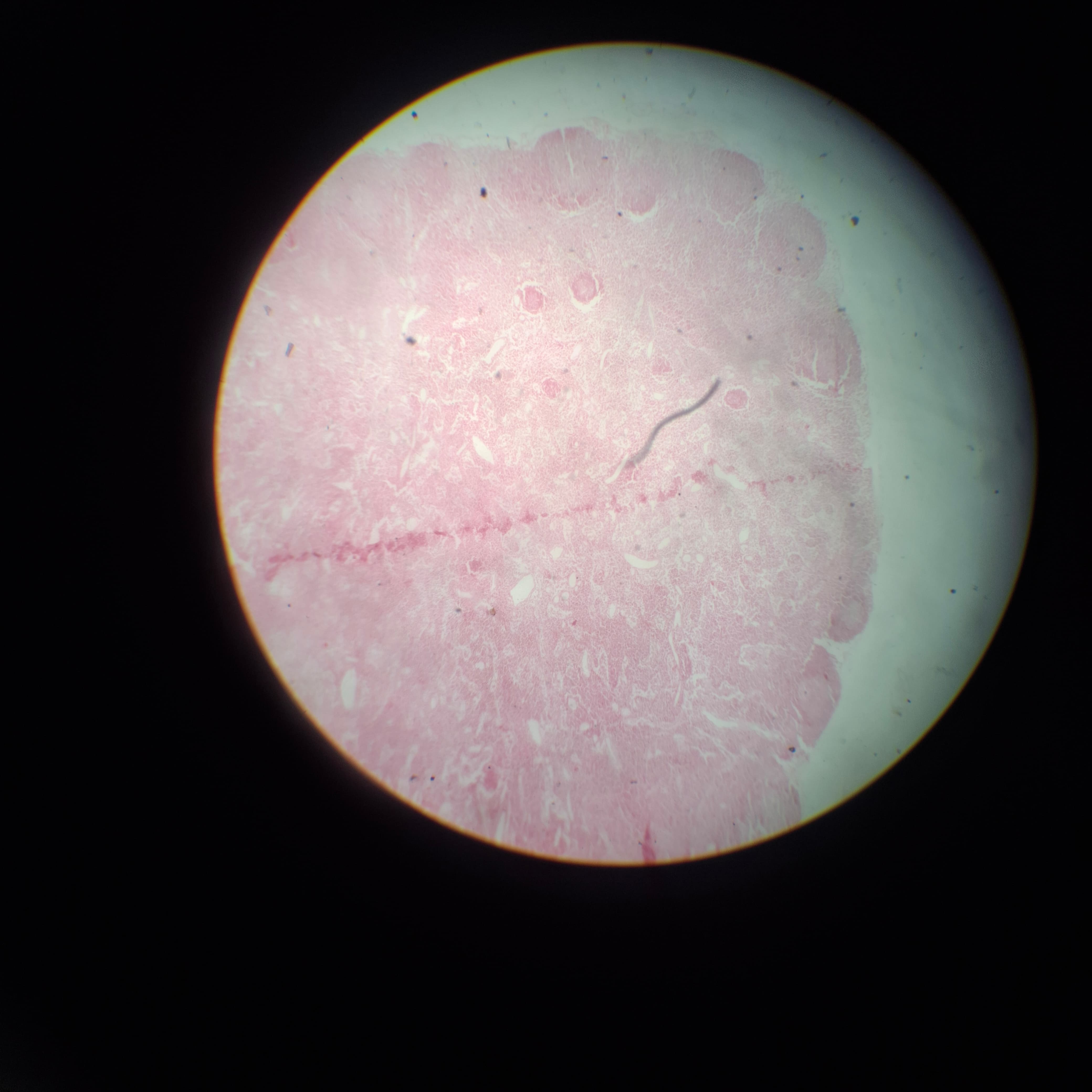 Lymphoid Tissue