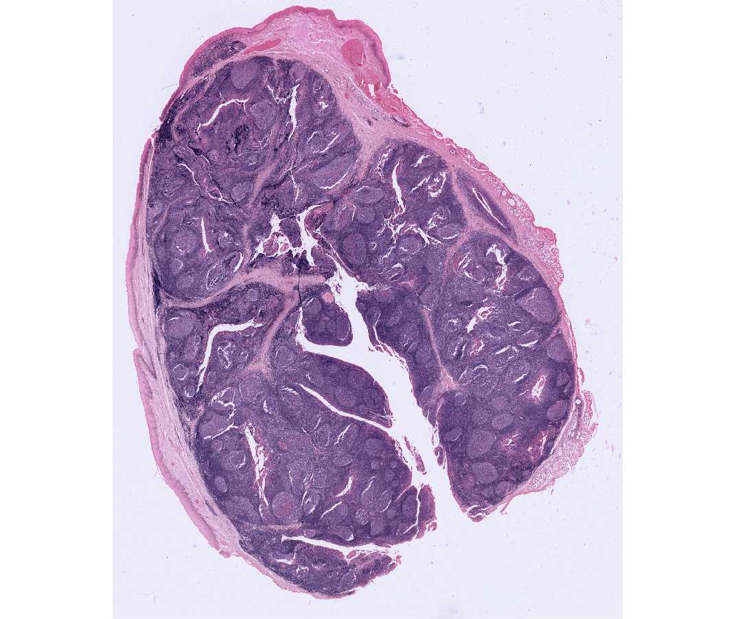 Palatine Tonsils