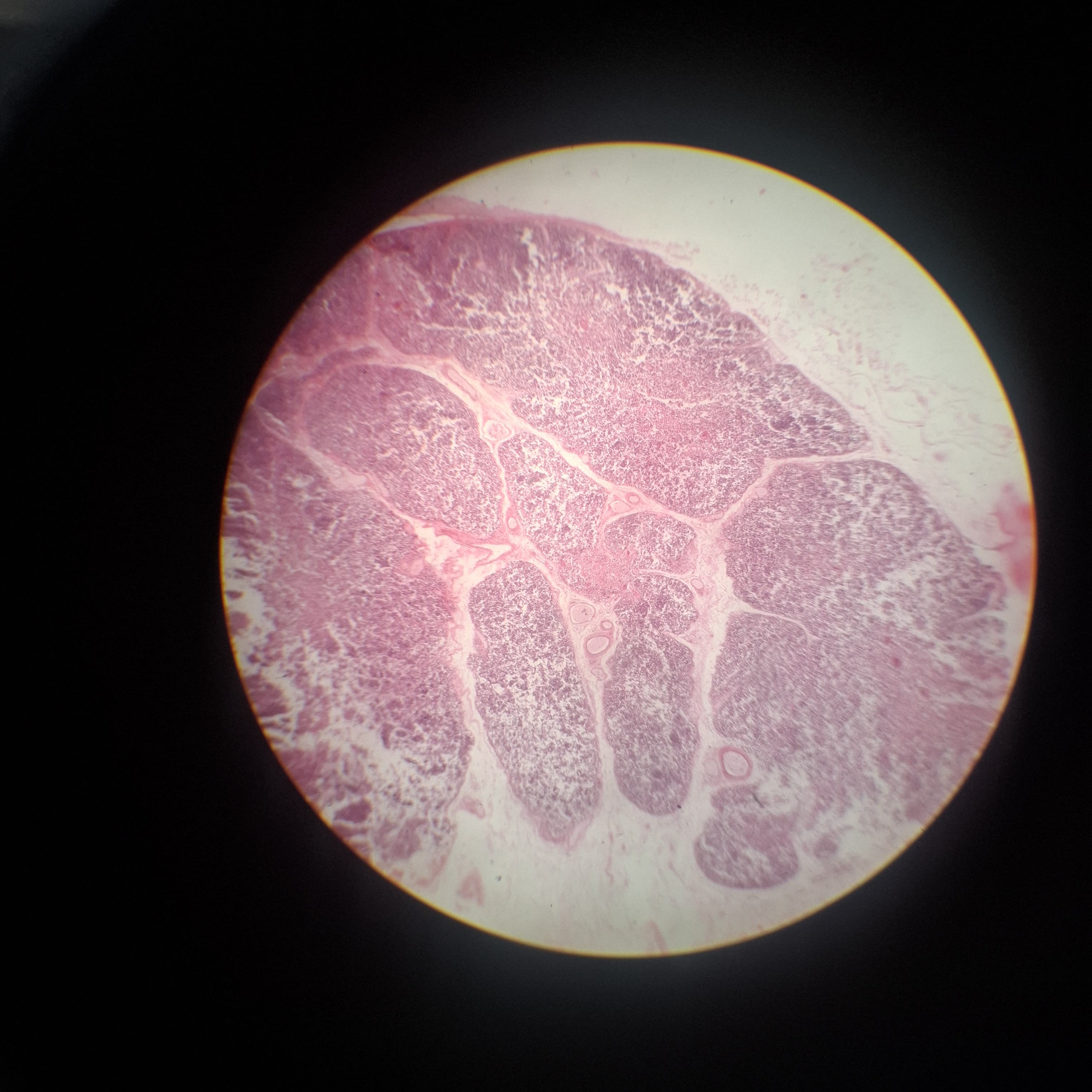 Thymus