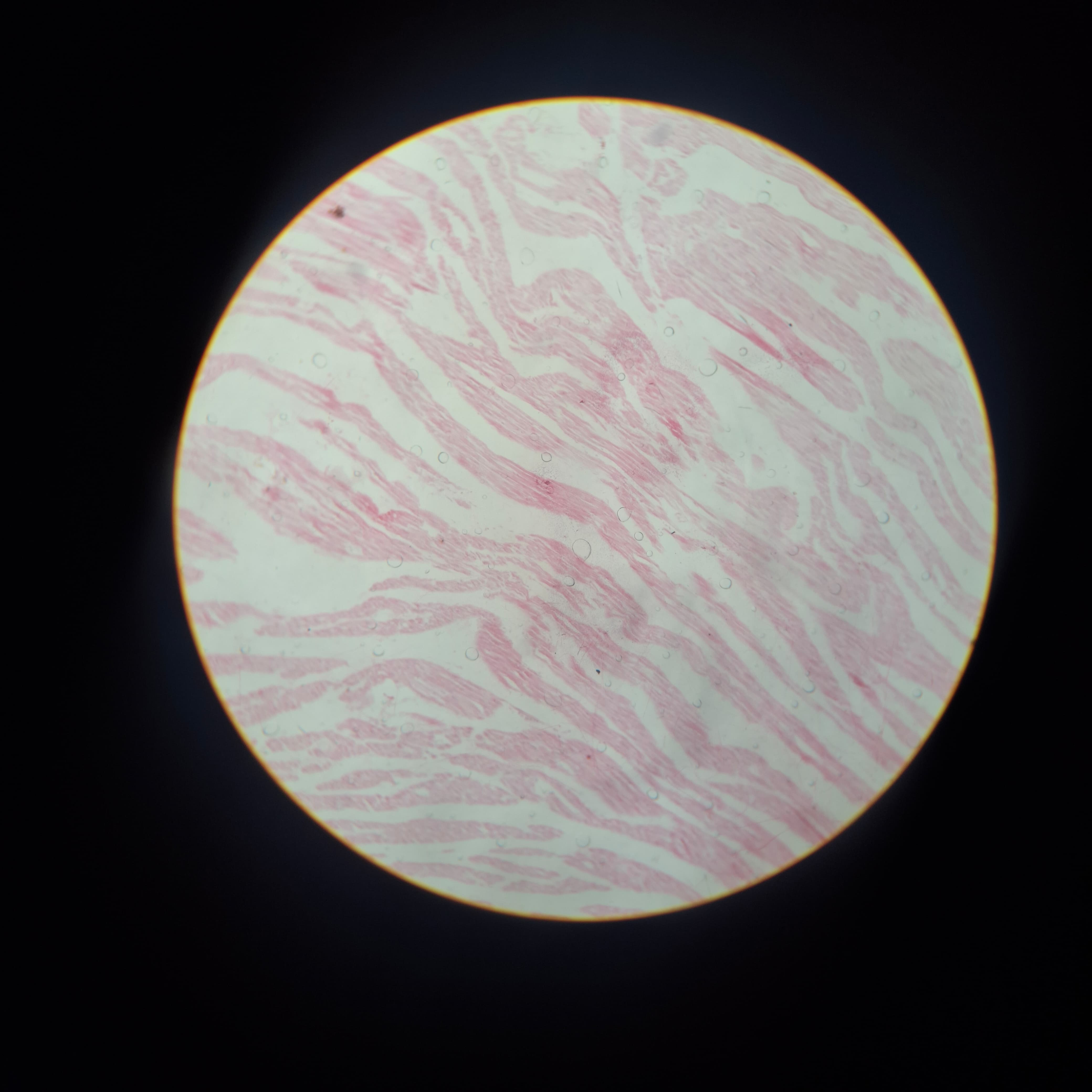 Cardiac Muscle