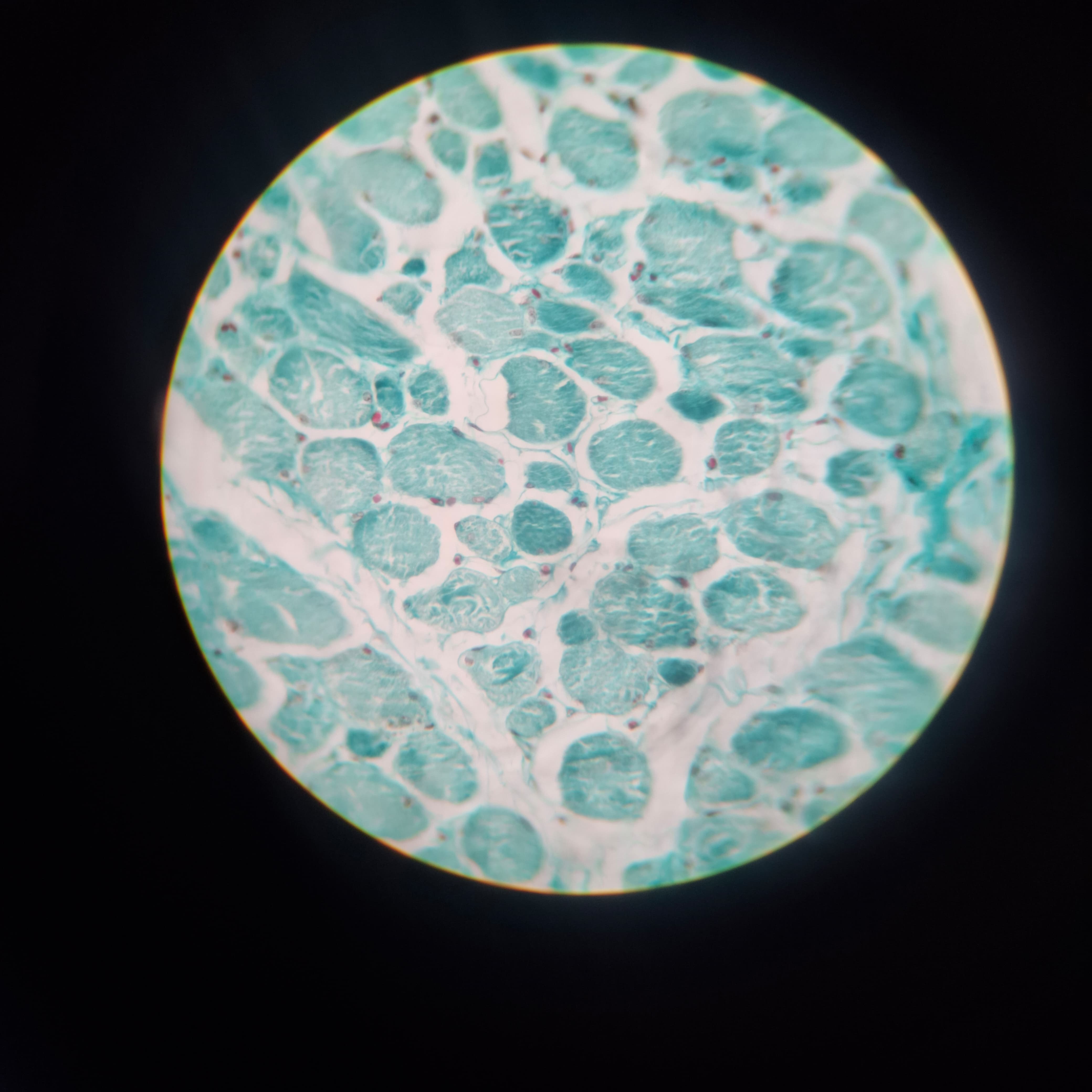 Skeletal Muscle