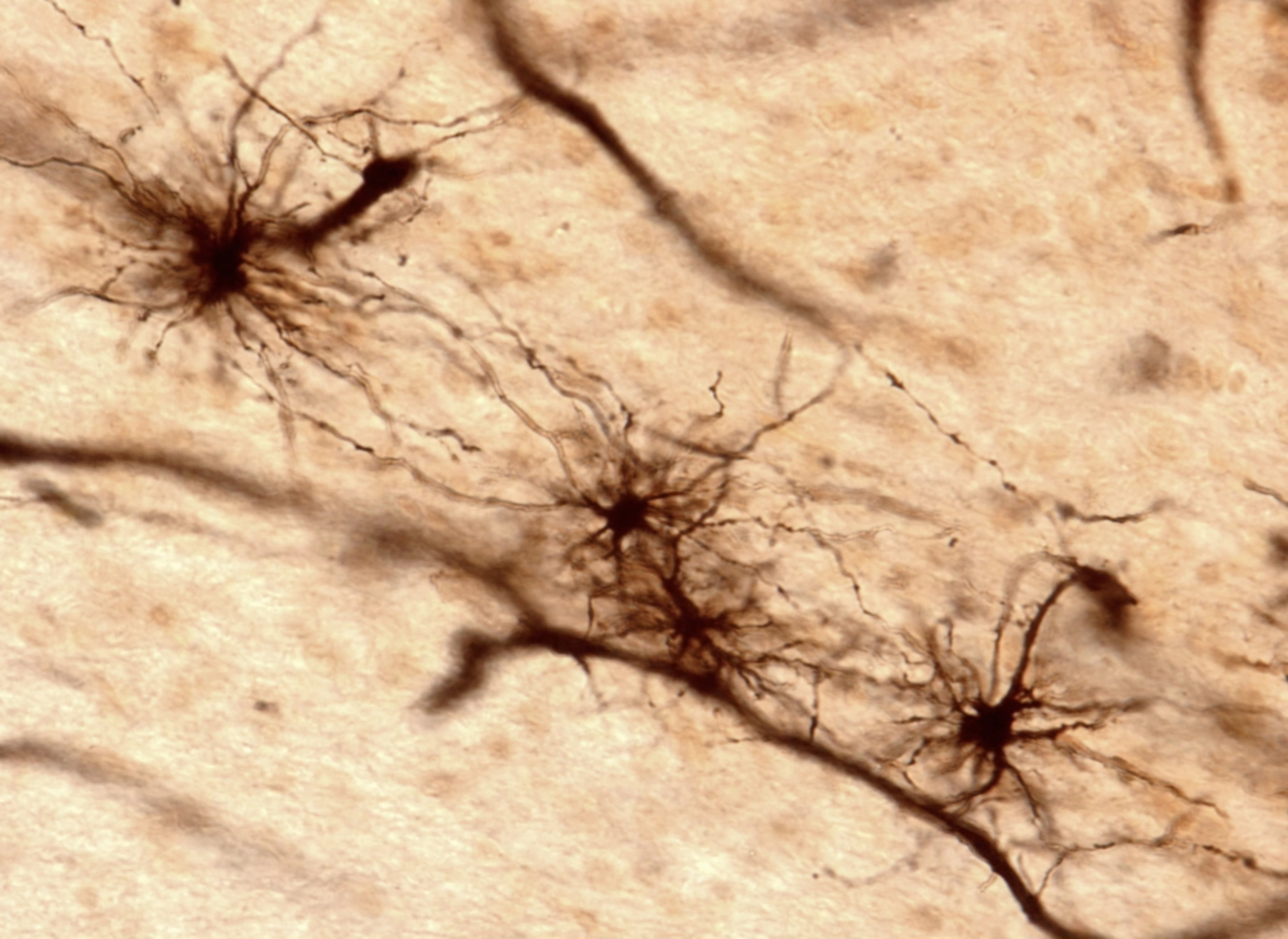 Fibrous Astrocytes