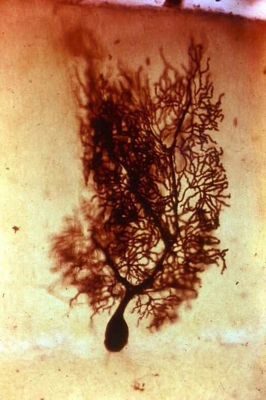 Purkinje Neurons