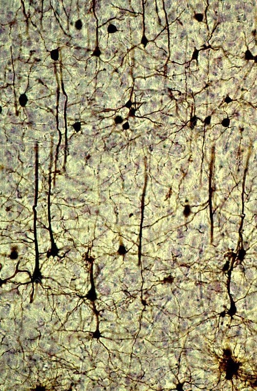 Pyramidal Neurons