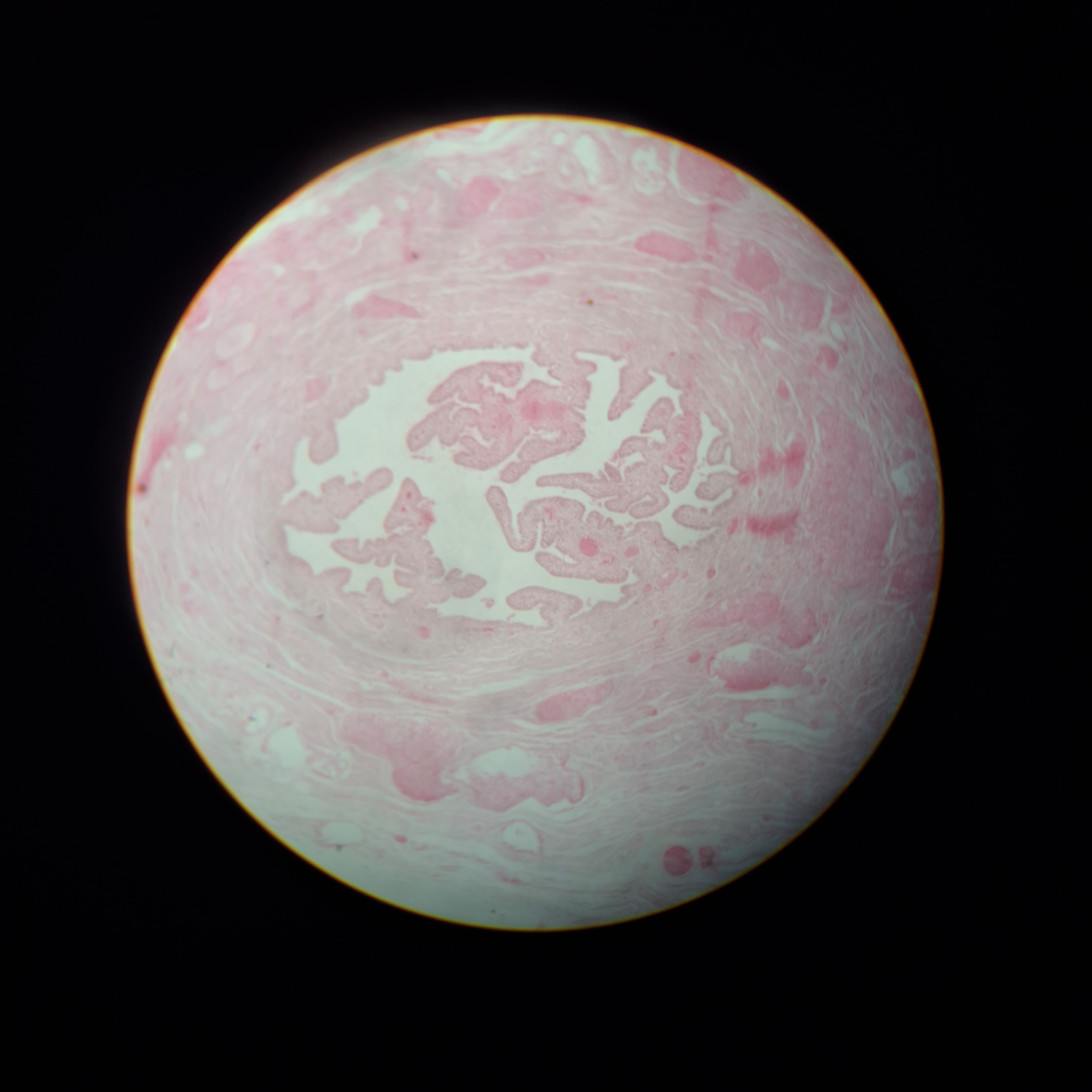 Fibrous Astrocytes