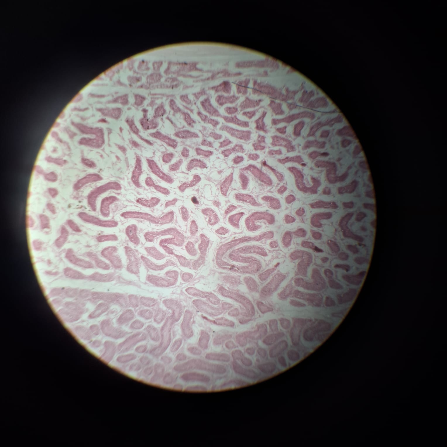 Seminiferous Tubules