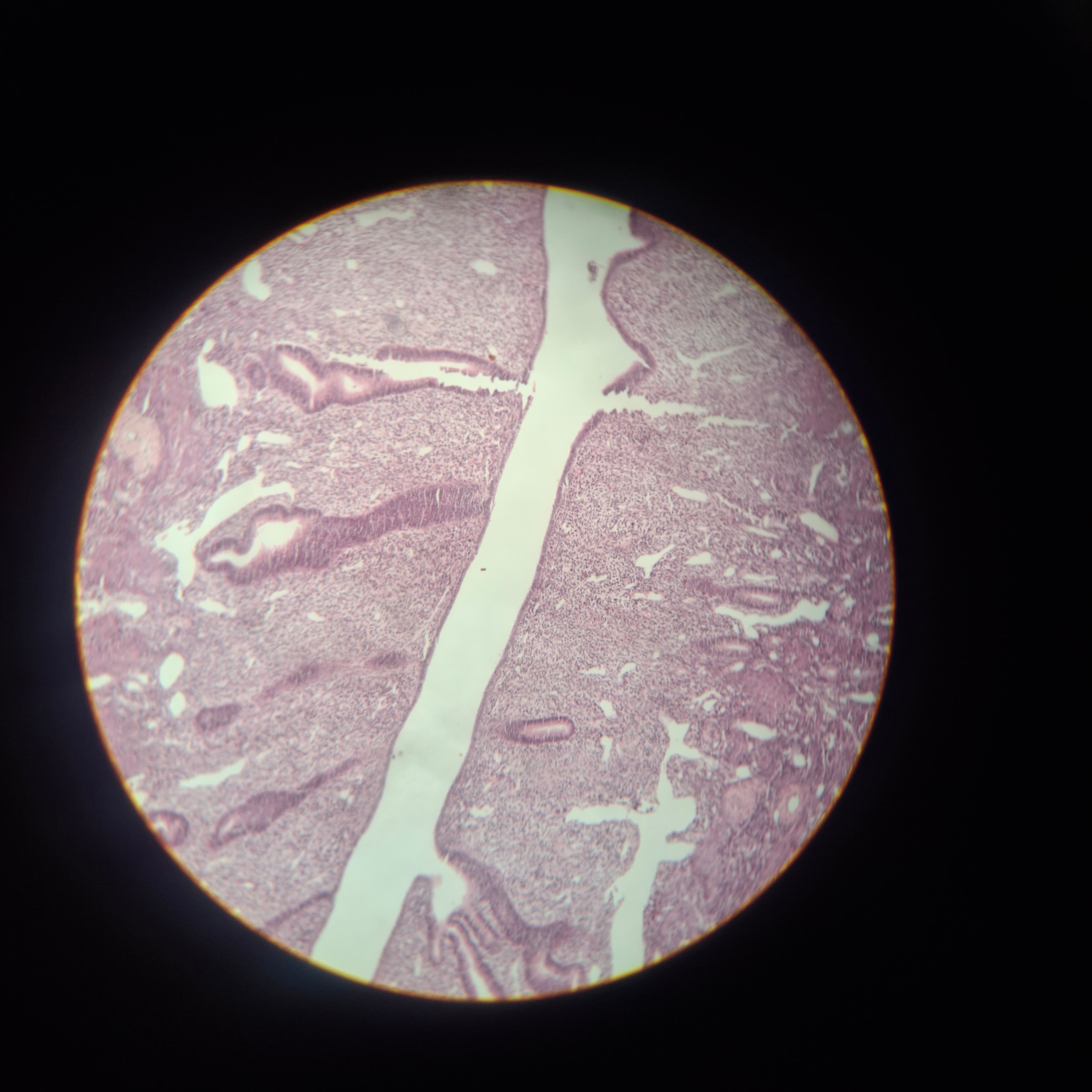 uterus