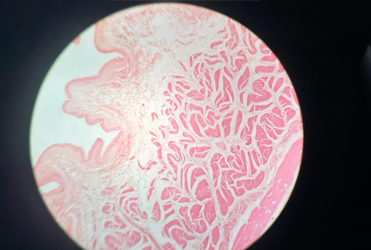 Bladder
