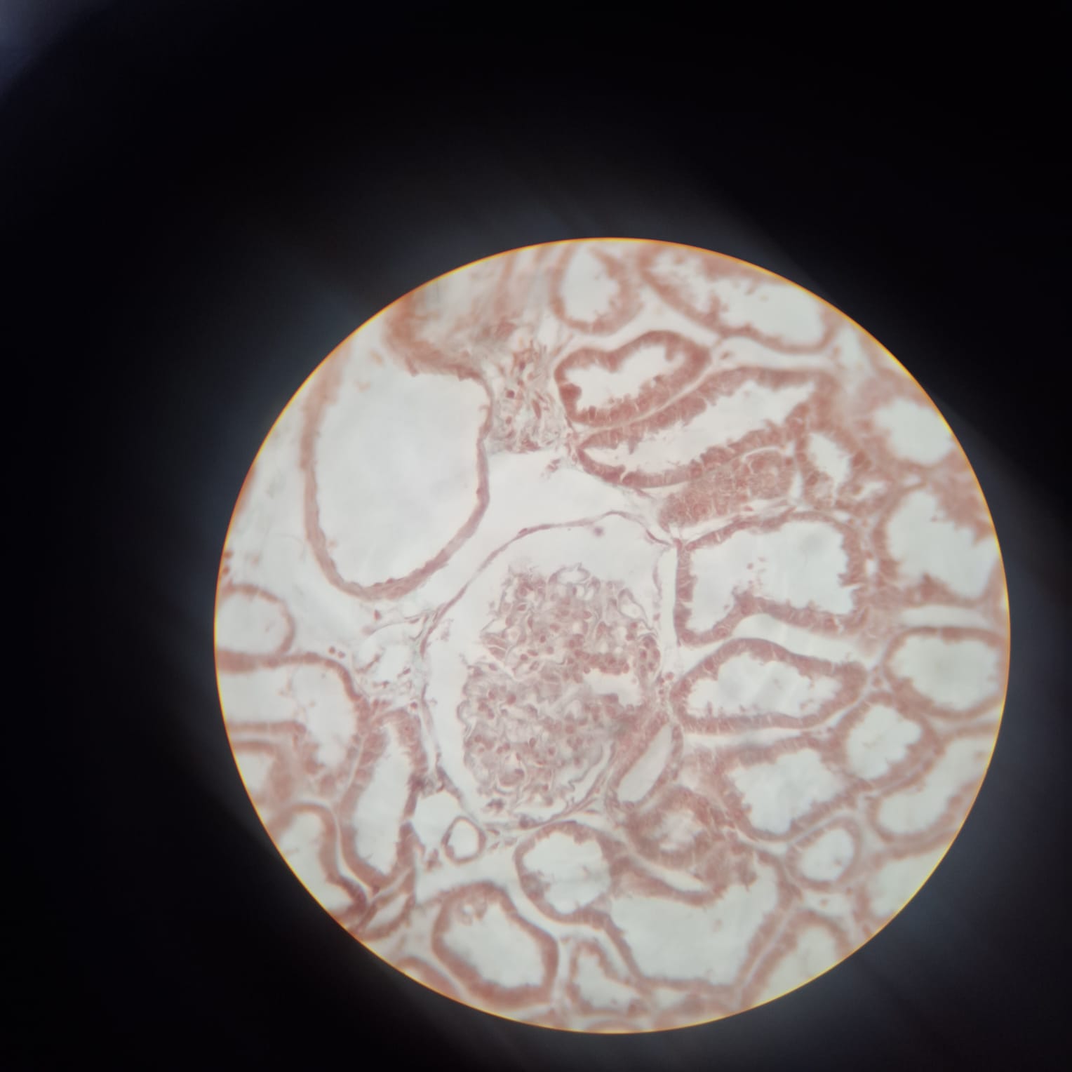 glomerulus
