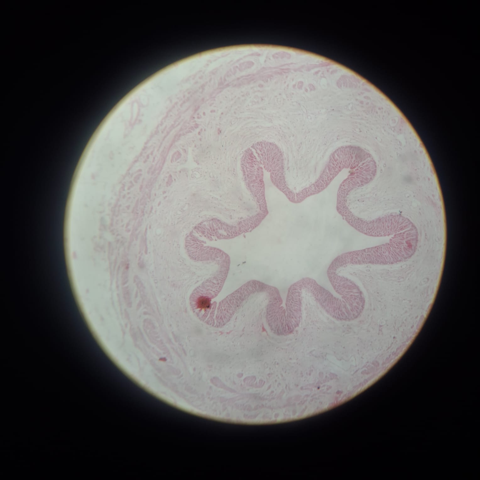 Ureter