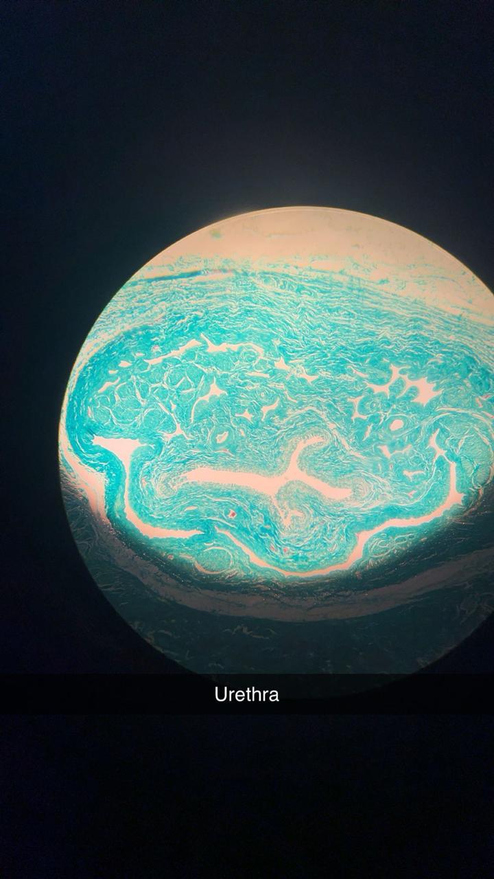 urethra